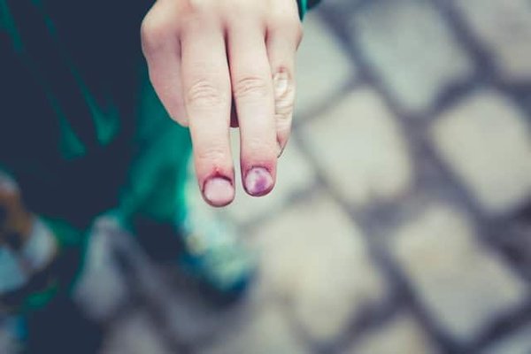 What Practices Can Prevent Overuse Injuries in Youth Sports?